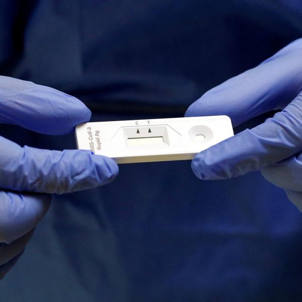 In vielen Apotheken wird es aber weiterhin möglich sein, sich auf COVID-19 testen zu lassen – allerdings nicht mehr kostenlos.