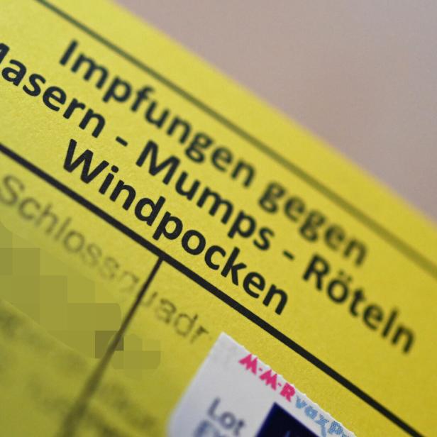Schon 59 bestätigte Masern-Fälle in Tirol, über 150 in ganz Österreich