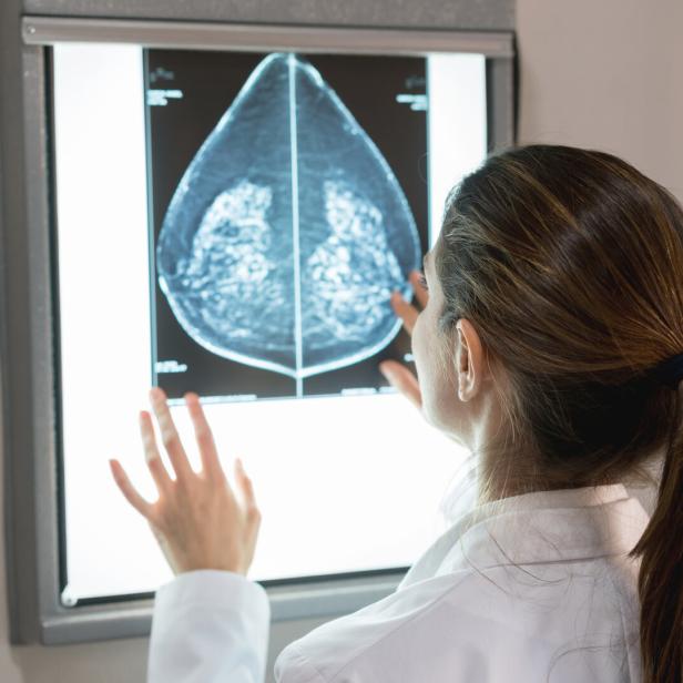 Frau begutachtet Bilder einer Mammografie.
