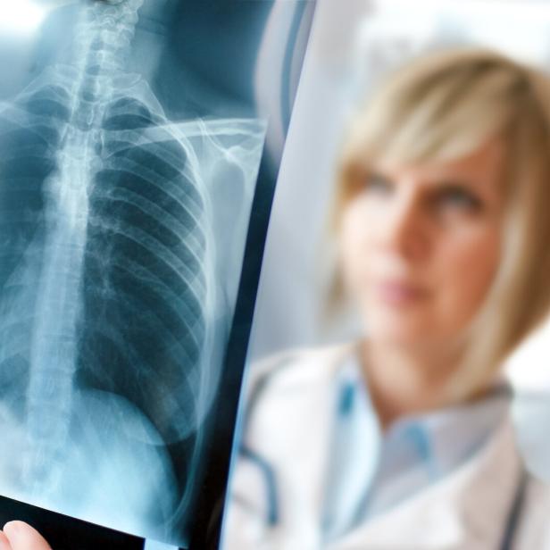 Eine Ärztin betrachtet ein Röntgenbild.