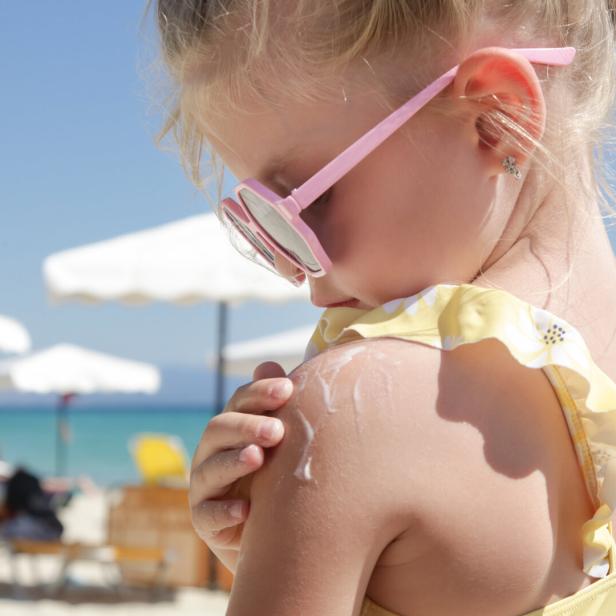 Studien zeigen: Sonnenbrände in der Kindheit steigern später das Hautkrebsrisiko.