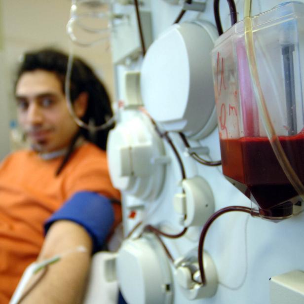 Ein Mann spendet Blutplasma, während das Blut durch Schläuche in eine Maschine und einen Behälter fließt.