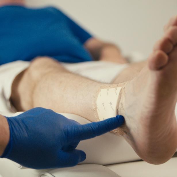 Ein Fuß mit Verband wird von einer Person mit blauen Handschuhen untersucht.