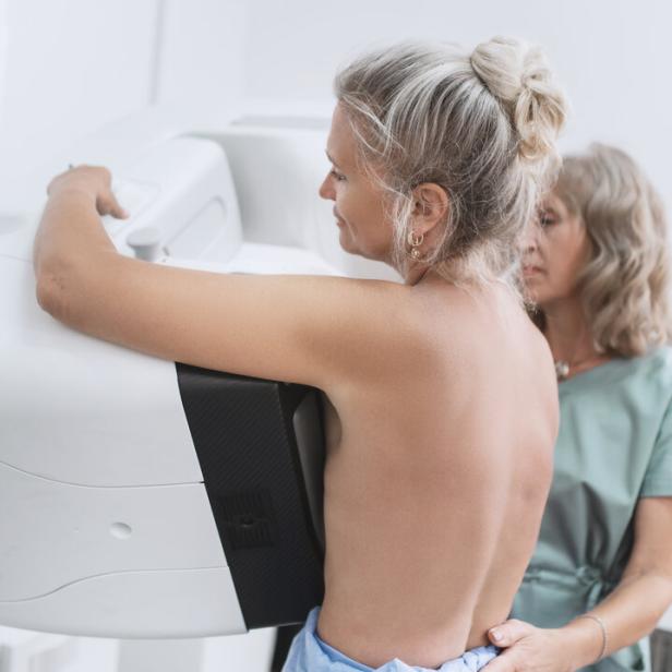A nurse helps a patient undergo a mammogram procedure.