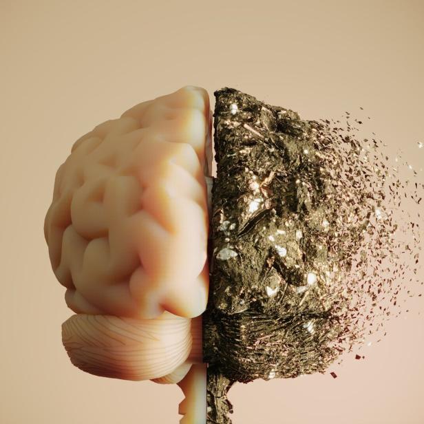 Human brain with cognitive decline concept