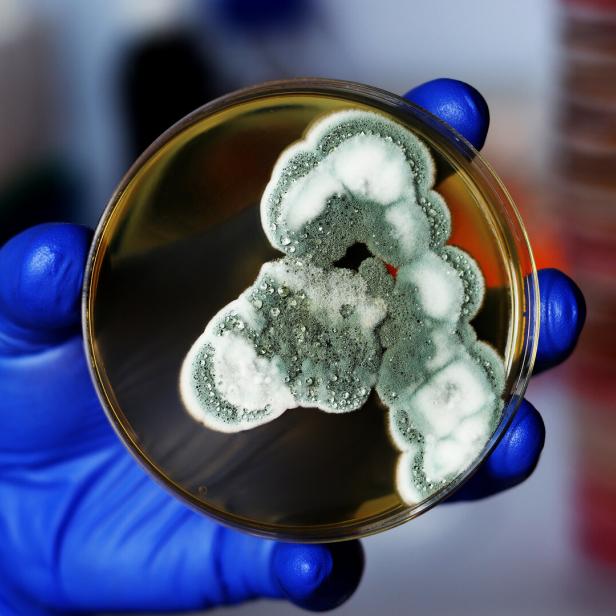 Eine Hand mit blauem Handschuh hält eine Petrischale mit grün-weißem Schimmelpilz.