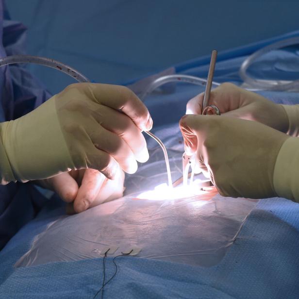 Ein Chirurg operiert mit Handschuhen und Instrumenten unter hellem Licht.