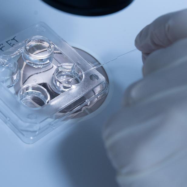 Künstliche Befruchtung im Labor