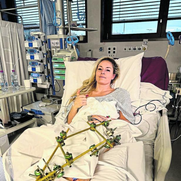 U.S. skier Lindsey Vonn lies in a hospital bed, after she crashed during the Women's Downhill, in Treviso