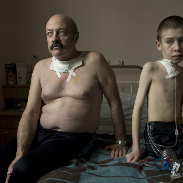 Ein Mann mit Schnurrbart und ein Junge sitzen mit Verbänden am Hals auf einem Bett.