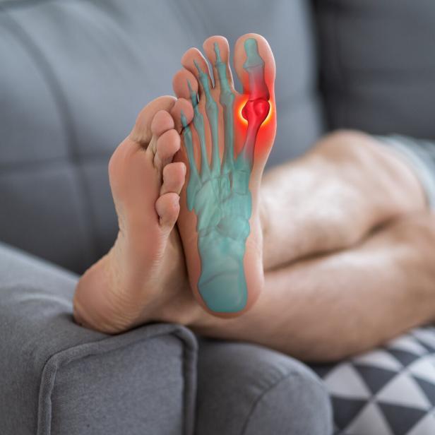 Joint diseases, hallux valgus, plantar fasciitis, man's leg hurts, pain in the foot