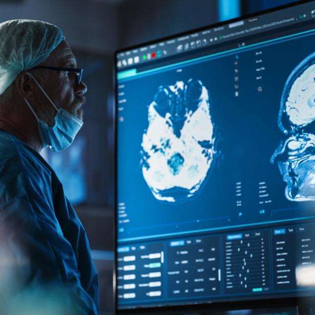 Medical Hospital Research Laboratory: Caucasian Male Neurosurgeon Looking At TV Screen With Brain MRI Scans Of Patient, Analyzing, Preparing For Complicated Neurosurgery, Wearing Surgical Gown.