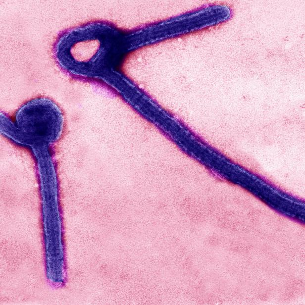 Zwei längliche, violette Strukturen mit gebogenen Enden auf rosafarbenem Hintergrund.