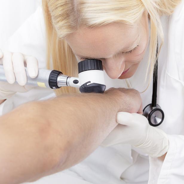 Eine Ärztin untersucht mit einem Dermatoskop die Haut am Arm eines Patienten.