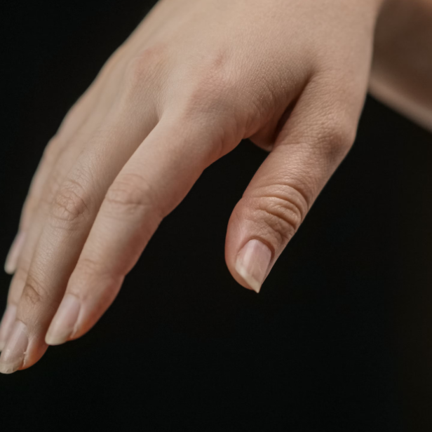Nahaufnahme einer Hand mit brüchigen, teils gesplitteten Fingernägeln vor dunklem Hintergrund.
