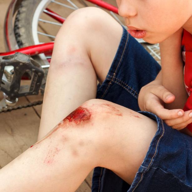 Broken wounded knee child. European boy in red T-shirt and denim shorts fell off bike and looks at wound abrasion. Children's summer holidays