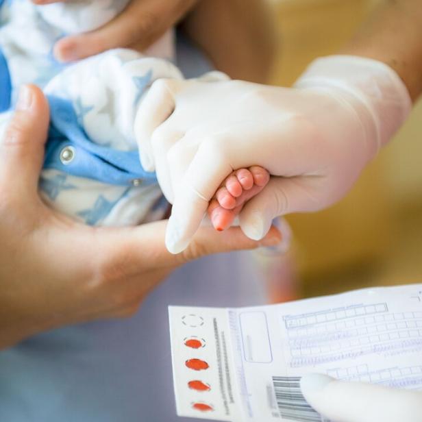 Einem Neugeborenen werden wenige Tropfen Blut aus der Ferse entnommen, diese auf eine Filterpapierkarte aufgebracht und im Labor des neugeborenen-Screeenings ausgewertet.
