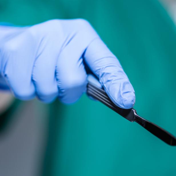 Hand of doctor holding scalpel