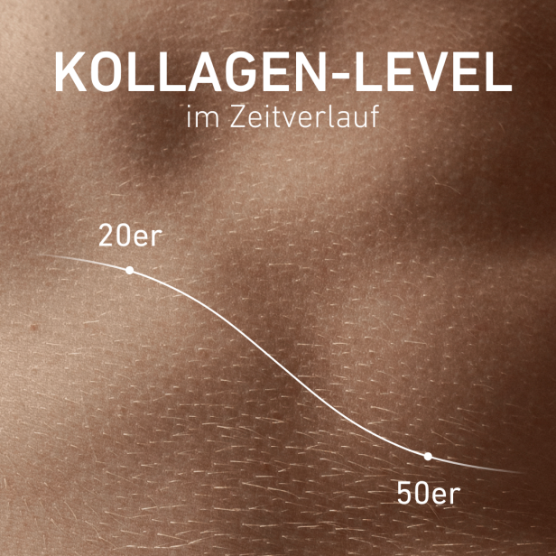 Infografik zum Kollagen-Level im Zeitverlauf von 20 bis 50 Jahre.