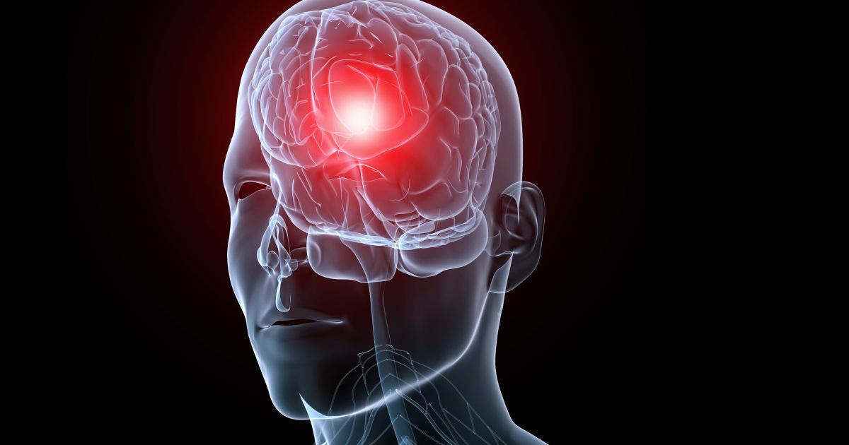 Epilepsie partnersuche