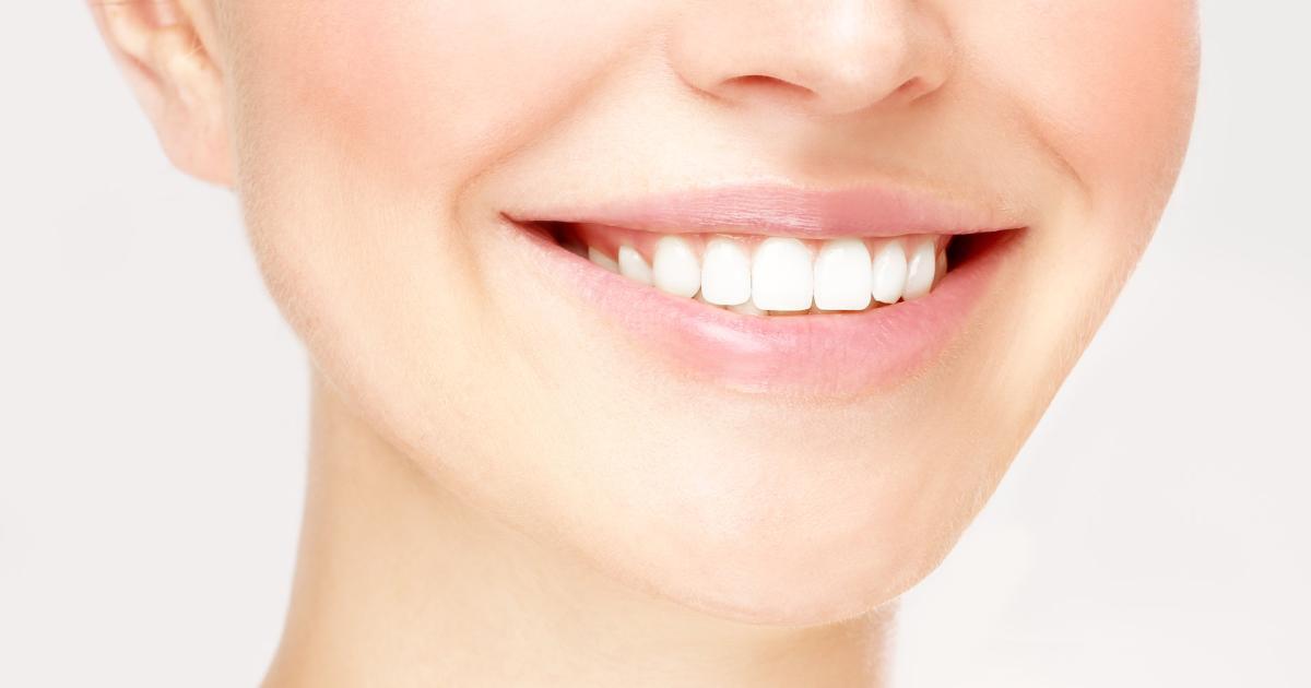 ZahnTrend Die günstigere Alternative zu Veneers