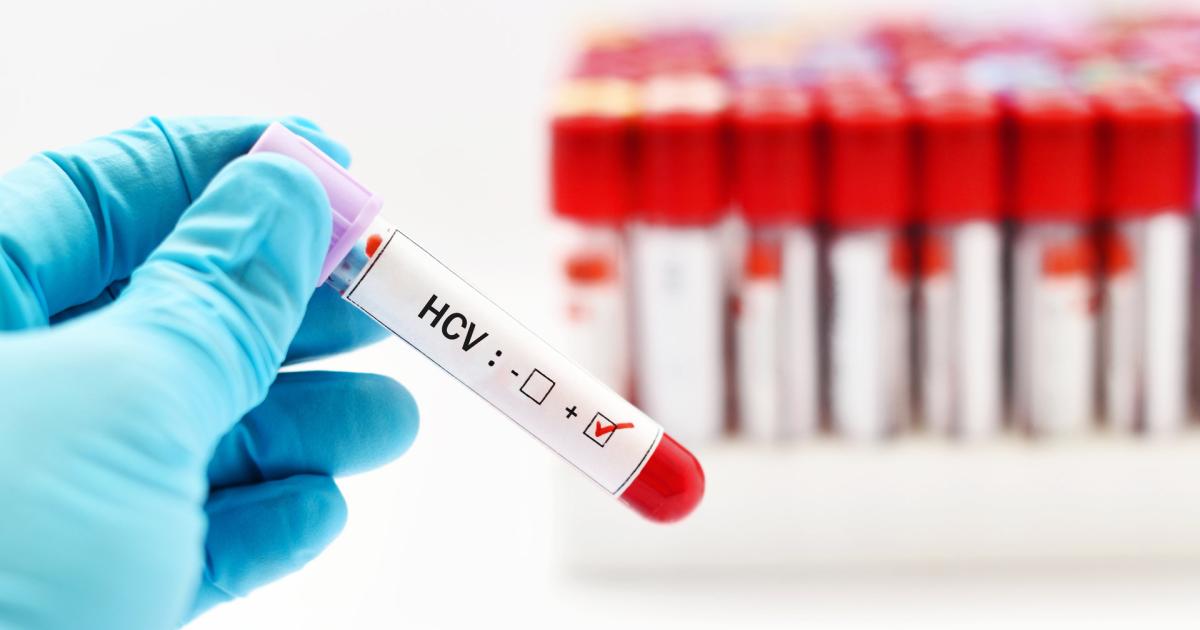 Hepatitis c partnersuche
