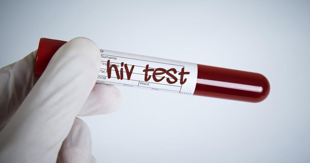 Virusevolutie: een agressievere vorm van hiv ontdekt in Nederland