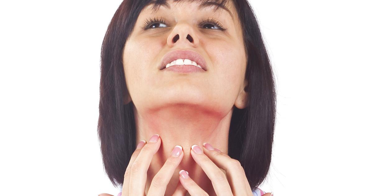Partnersuche psoriasis