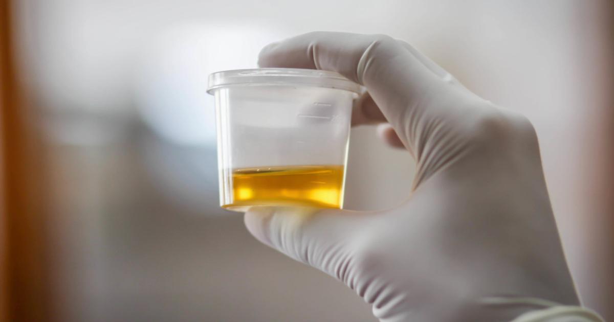 Frau hatte ständig Alkohol im Urin Neue Krankheit entdeckt