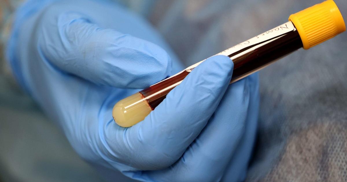 Nach Corona Infektion Wie Lange Immun