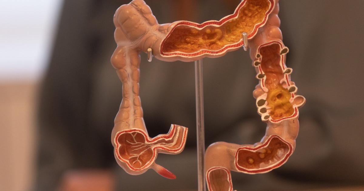 Diagnose-Darmkrebs-Mit-Humor-gegen-das-Tabu