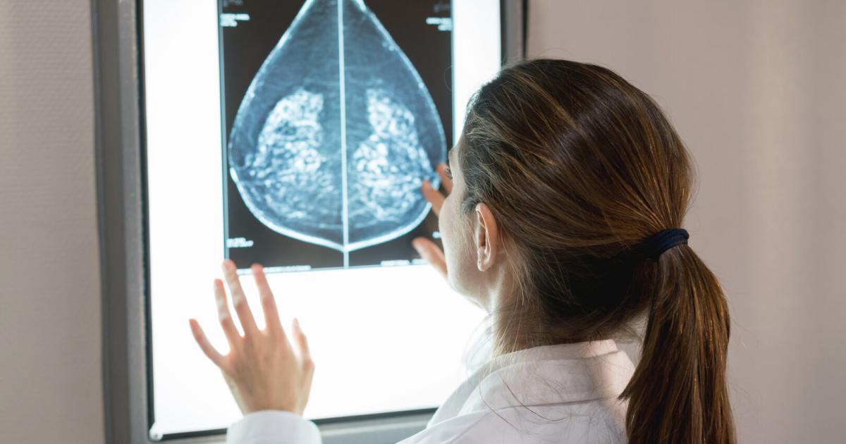 Sensors in bras could improve early detection of breast cancer
