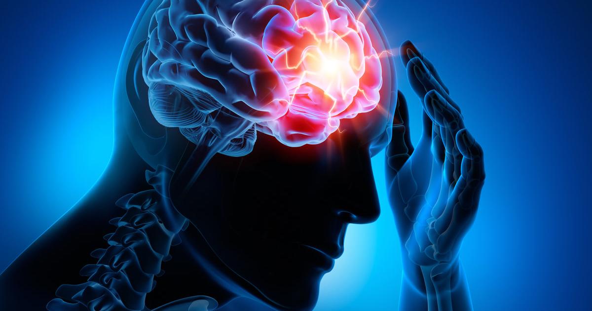 Immer mehr junge Menschen erleiden einen Schlaganfall