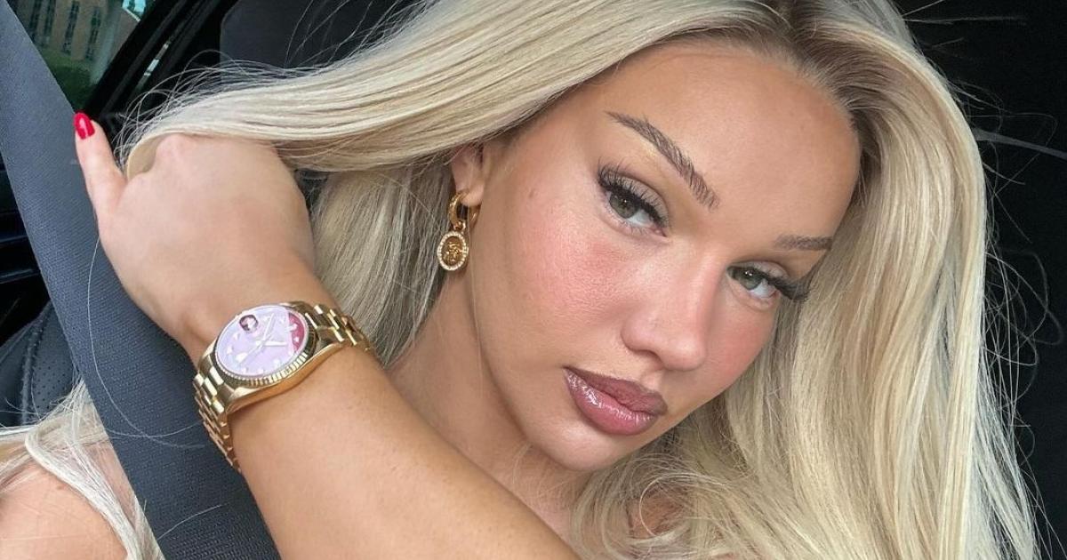 Shirin-David-So-viele-Sch-nheits-OPs-hatte-die-Rapperin
