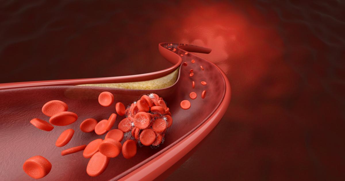 sind-cholesterinsenker-gef-hrlich-6-fragen-und-die-antworten-dazu