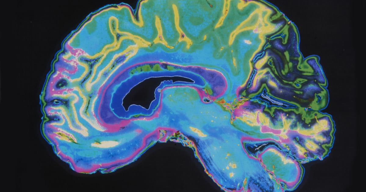 -wendepunkte-in-diesem-alter-ndert-sich-das-gehirn-fundamental