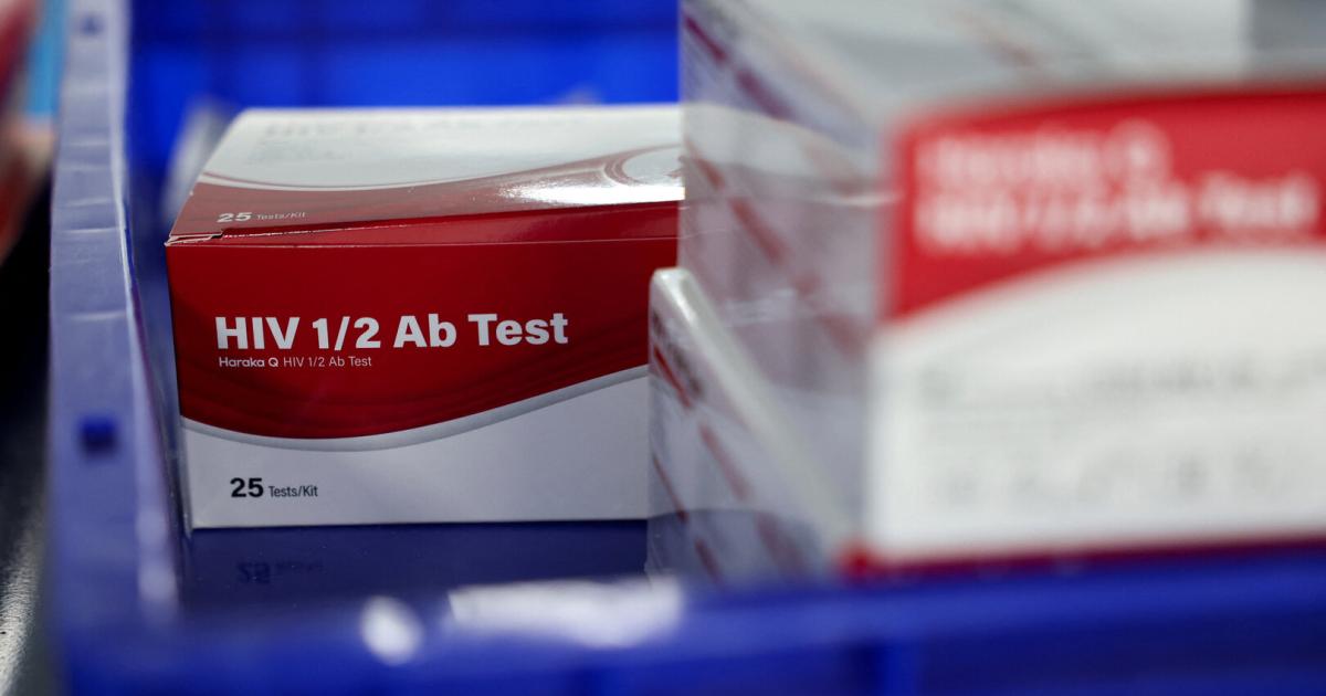 HIV-Erkrankungen-in-Europa-Sp-te-Diagnosen-erschweren-Therapie