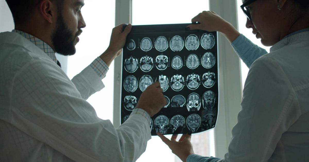 Seltener-Fall-Unheilbarer-Hirntumor-bei-27-J-hriger-pl-tzlich-weg