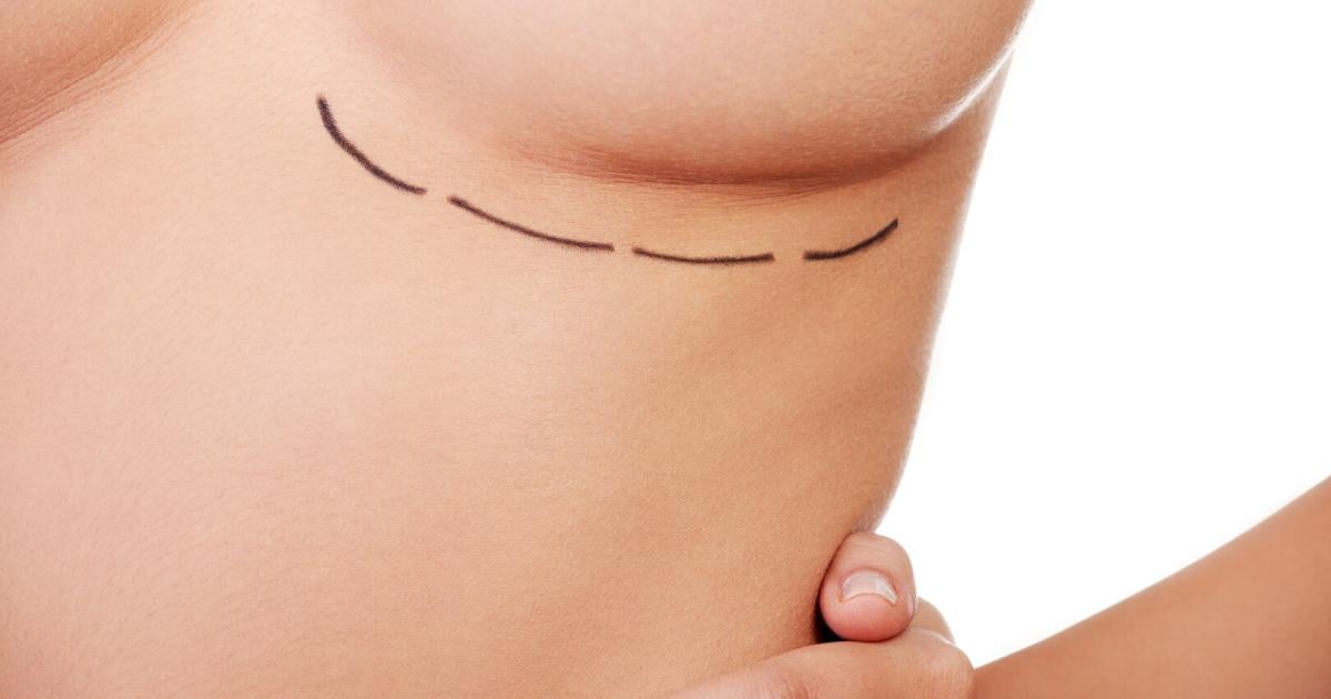 S-dkoreanische-Forscher-entwickeln-Alternative-zu-Brustimplantaten-ohne-OP