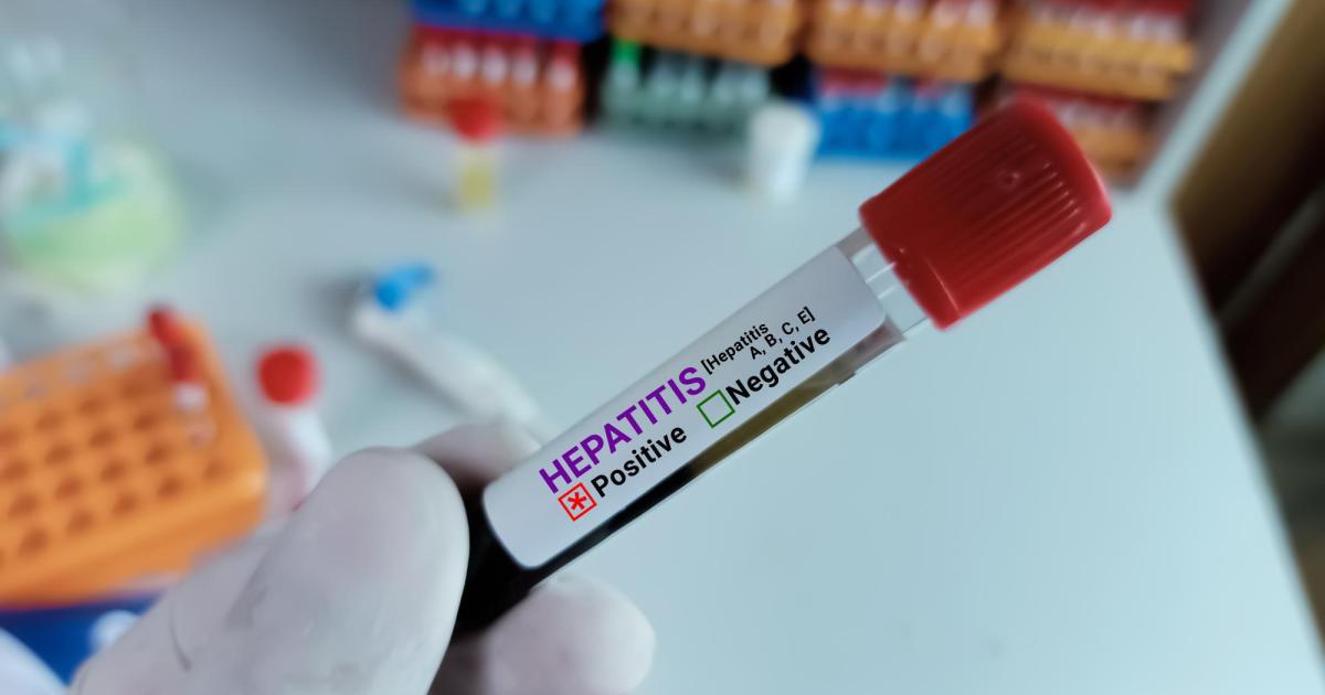 Chronische-Hepatitis-B-Neues-Medikament-macht-Hoffnung