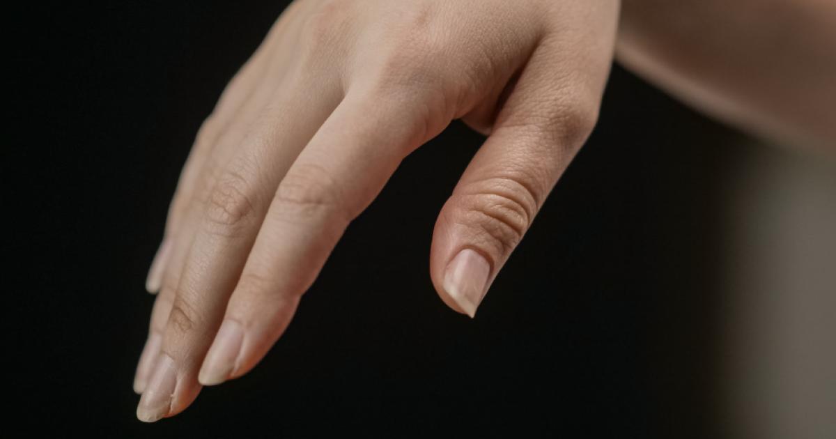 N-gel-als-Spiegel-des-K-rpers-Was-br-chige-Fingern-gel-ber-die-Gesundheit-verraten