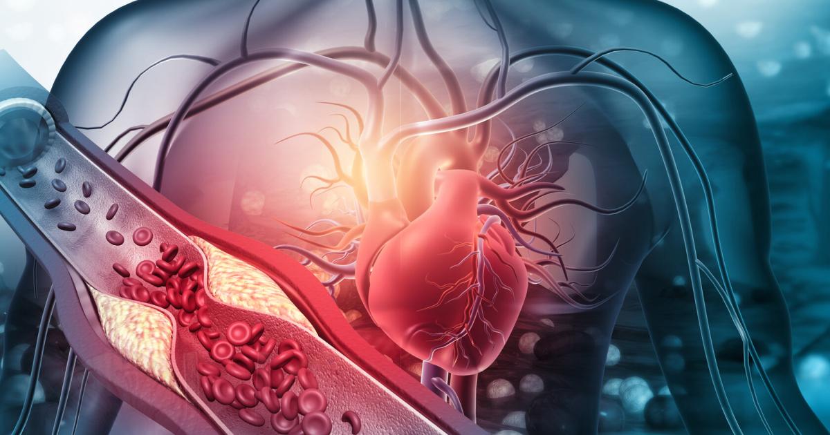 Schlucken-statt-Spritzen-Neuer-Cholesterinsenker-in-Tablettenform