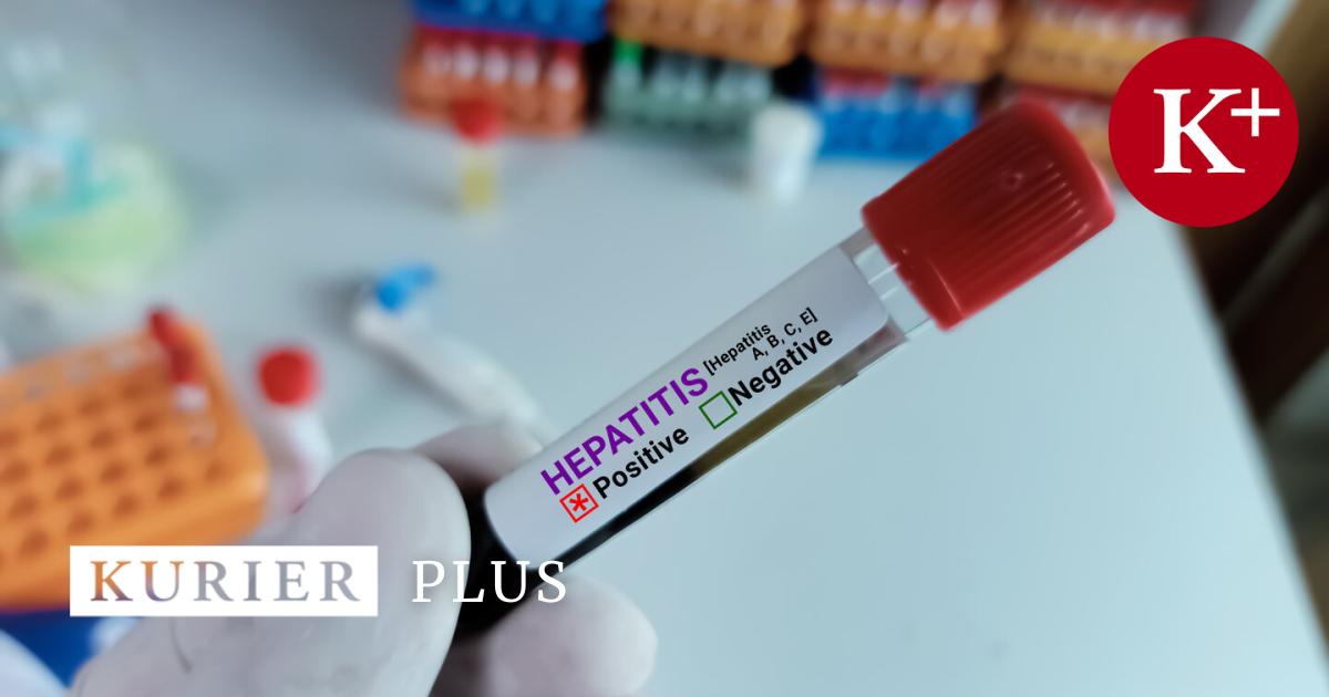 Anstieg-der-Hepatitis-A-F-lle-Die-wichtigsten-Fragen-und-Antworten