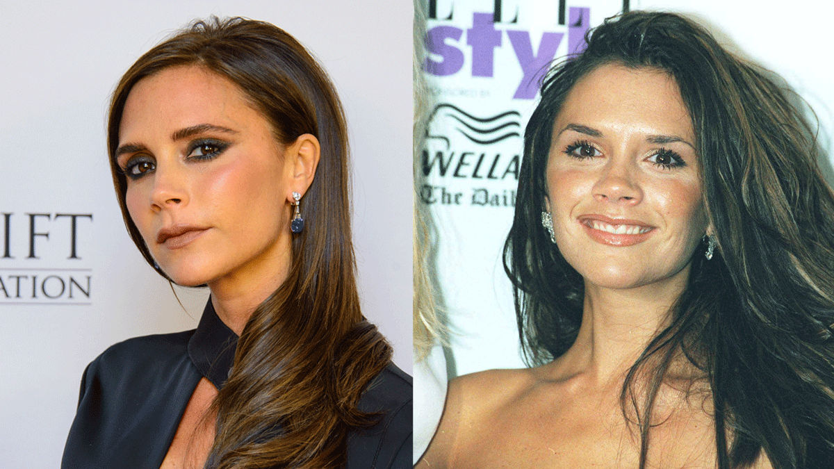 So ein kleines Stupsnäschen aber auch - als Shootingstar bei den Spice Girls hatte Victoria Beckham noch kein so feingliedriges Näschen.