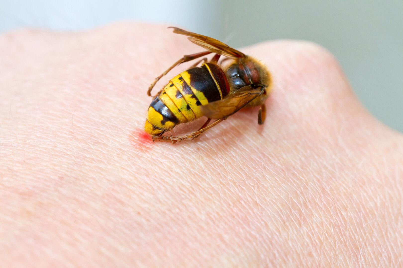 Das große Surren: Welche Insekten welche Stiche hinterlassen und was hilft