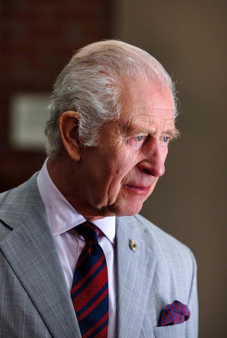 König Charles spricht über unangenehme Nebenwirkung seiner Krebsbehandlung