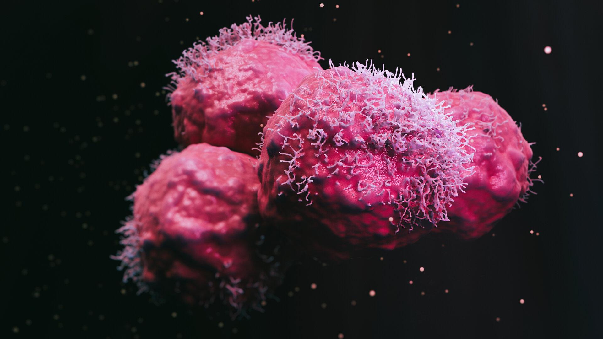 Mundbakterien auf Krebsjagd: Fusobakterien könnten bei Therapie behilflich sein