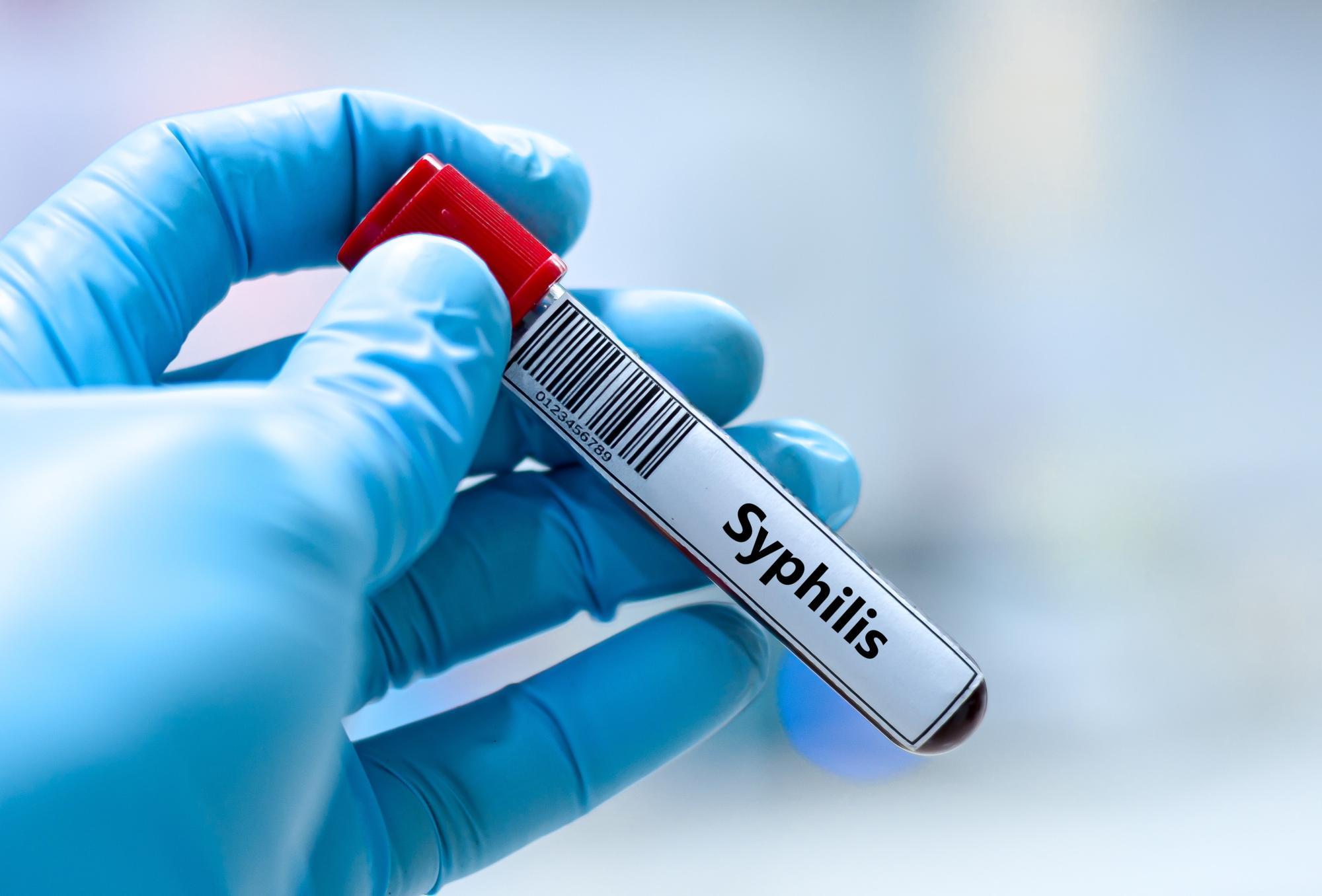 Deutschland: Syphilis-Infektionen auf dem Vormarsch