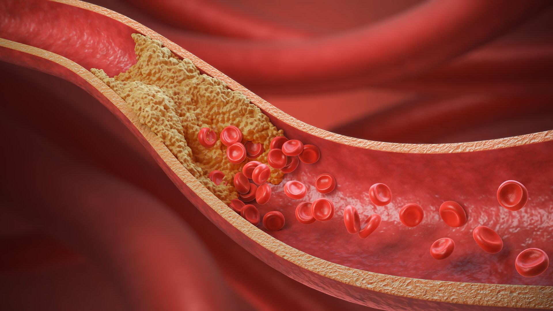 Cholesterinsenker: 