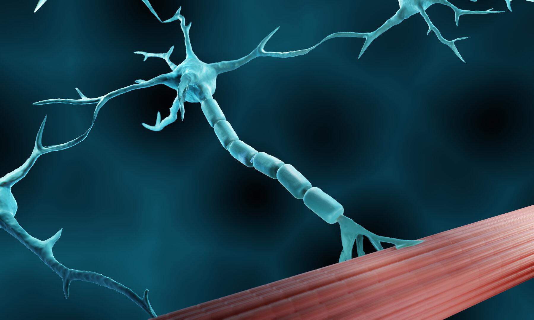 Michael Patrick: Was man über Motoneuronen-Krankheiten weiß